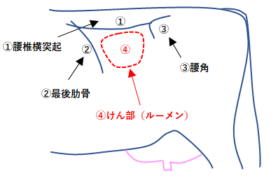 図1 RFSの観察部位