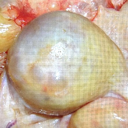 卵胞嚢腫の写真